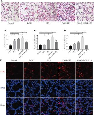 Antioxidant mitoquinone ameliorates EtOH-LPS induced lung injury by inhibiting mitophagy and NLRP3 inflammasome activation